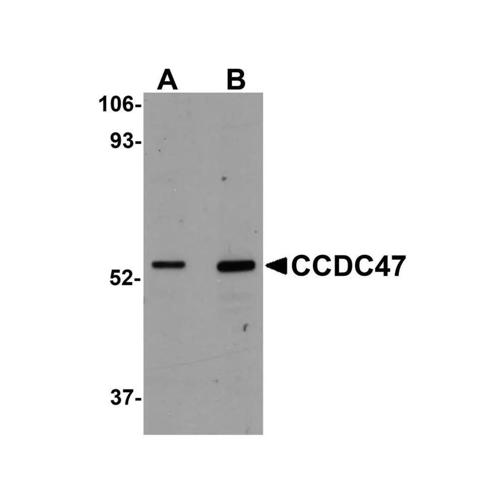 ProSci 5509 CCDC47 Antibody