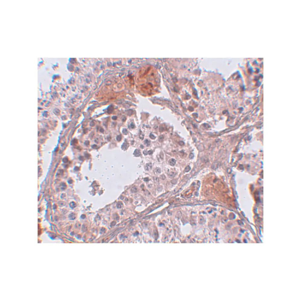 ProSci 5497 CLPH Antibody