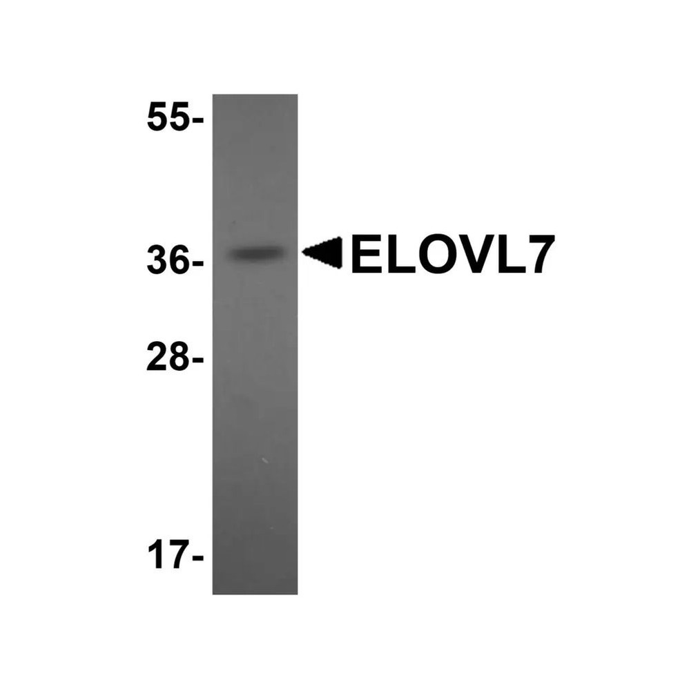 ProSci 5641 ELOVL7 Antibody