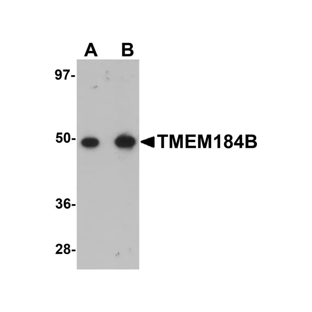ProSci 5683 TMEM184B Antibody
