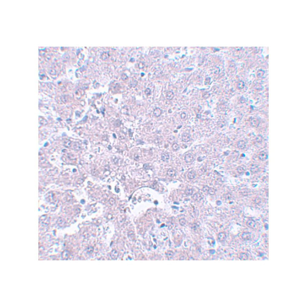 ProSci 5593 CALHM1 Antibody