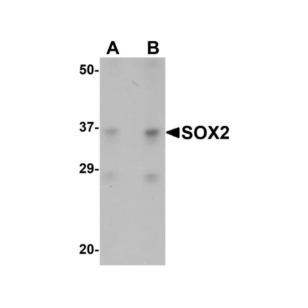 ProSci 5583 SOX2 Antibody