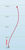 DGA Tremor - Spark line - | 6 | 5 | -4 | 1 | - Stable-Straight DGA Tremor - Spark line - | 6 | 5 | -4 | 1 | - Stable-Straight