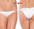 Tie Side Extreme Cut Scrunch Bottom * 1177SL