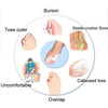 Silicone Bunion Buddy - 10 Piece Toe Set
