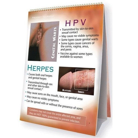 STD Flip Chart Health edco 43162