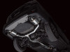 AWE 20-25 Subaru Outback (Wilderness & XT) 0FG Catback Exhaust w/Dual BashGuards - 3015-38246