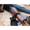 Slishman femoral traction splint  (STS) - Original Generation