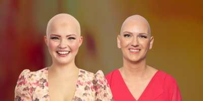 Mujeres con alopecia: fuerza y belleza