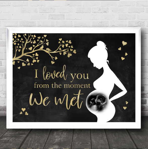 Pregnancy Ultrasound Scan Photo Black Gold Personalized Gift Art Print