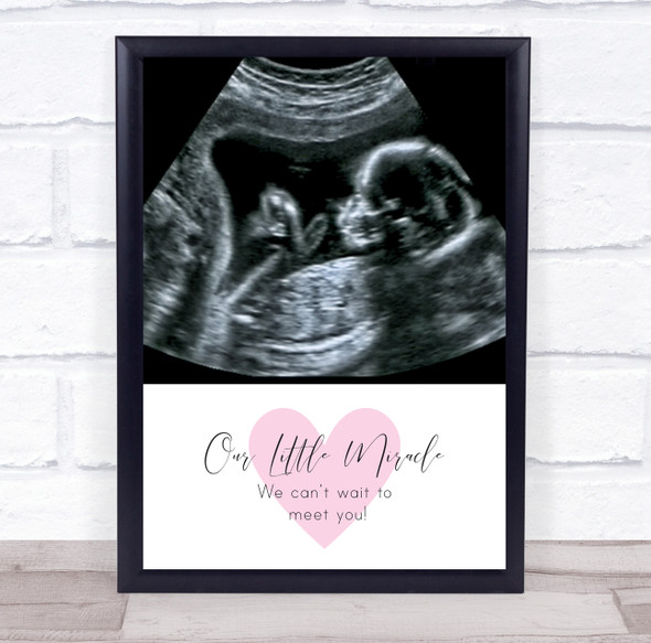 Baby Pregnancy Ultrasound Scan Photo Our Little Miracle Personalized Gift Print