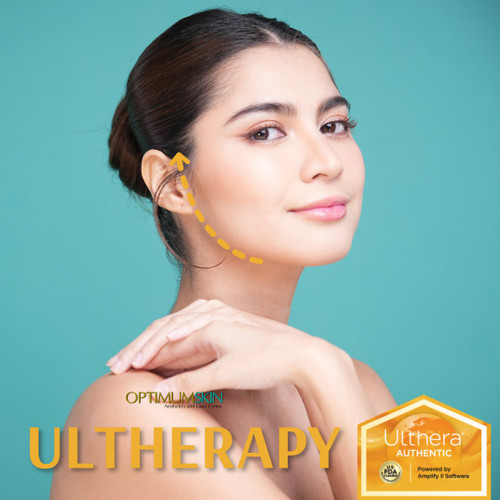 Ultherapy