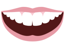 Mouth showing top and bottom veneers
