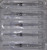 Syringe with Needle - 10cc 20G 1.5"