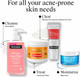 Neutrogena Oil-Free Acne Wash Pink Grapefruit 9.1oz – image 7