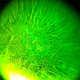 Fertil Focus Personal Ovulation Microscope Additional Product Image 6