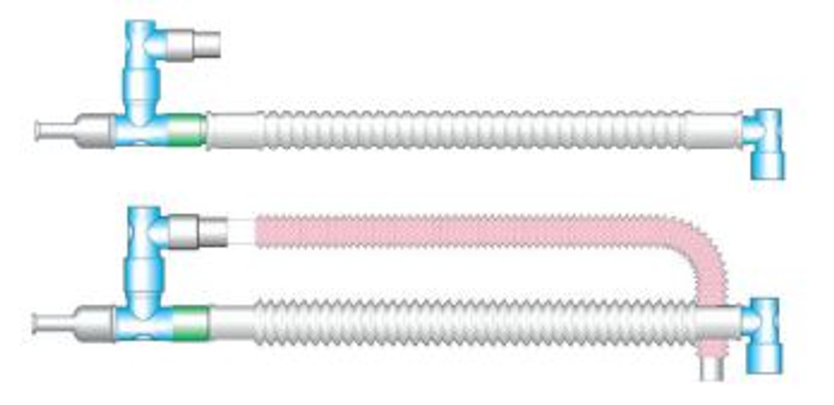 What Are The Different Vent Circuit Types? 