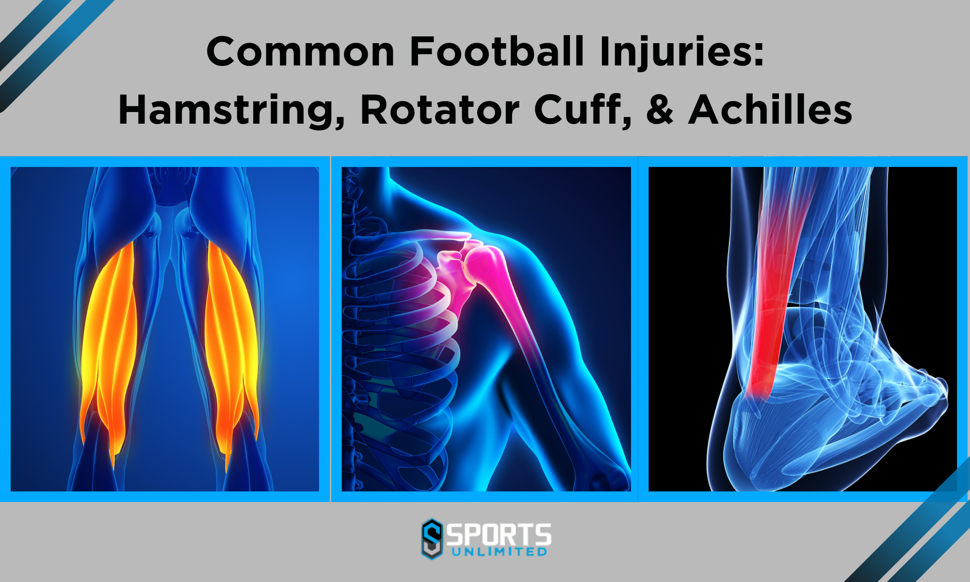 Common Football Injuries: Hamstring, Rotator Cuff, and Achilles