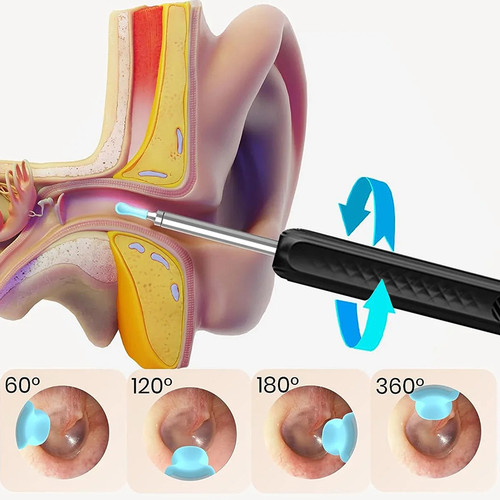 Wireless WiFi Ear Wax Cleaner