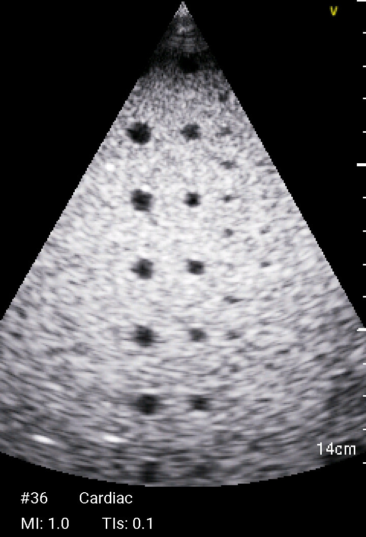 GE Vscan Extend