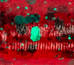 Redbug