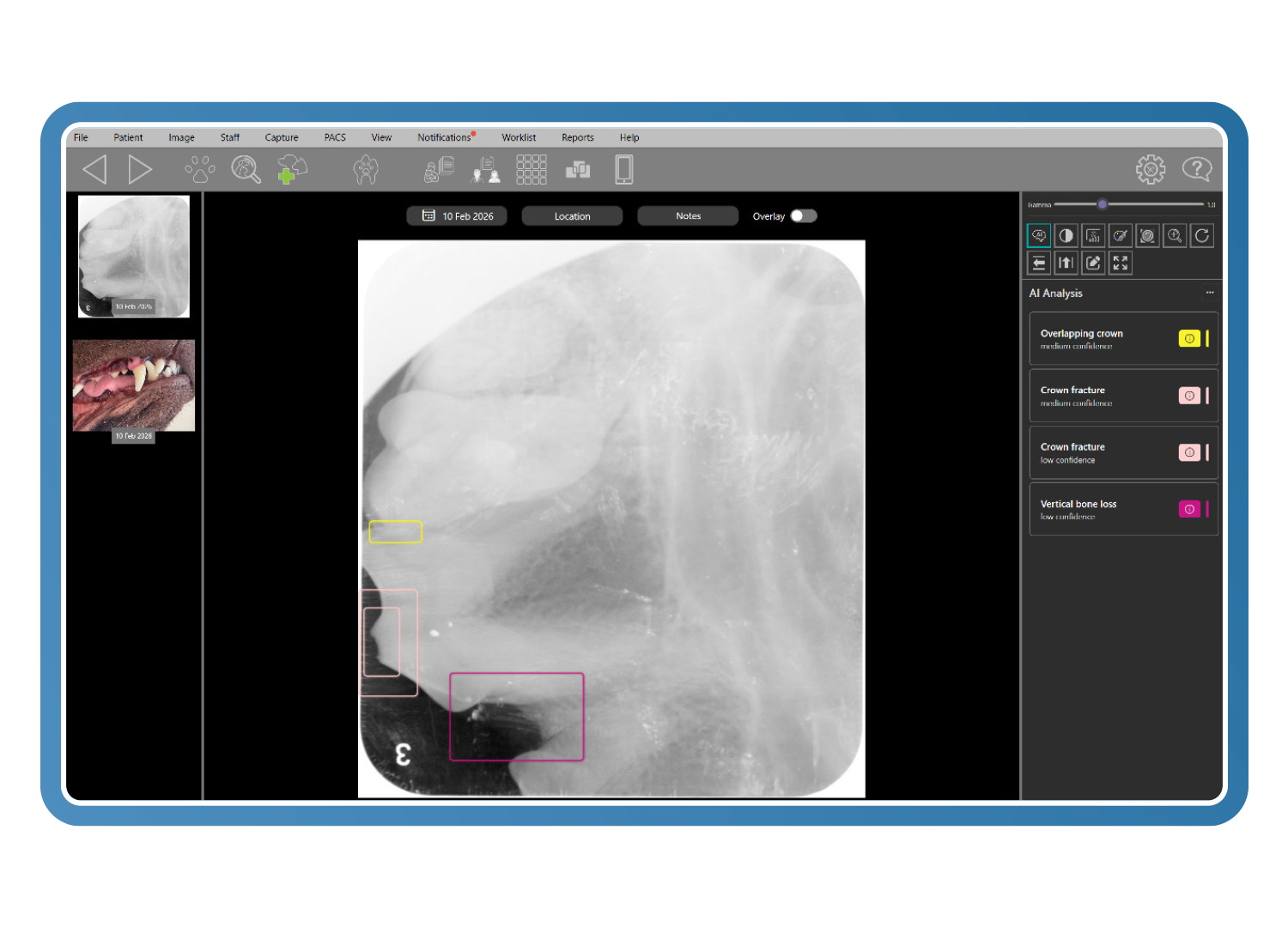 Suboptimal image - Clarity applied