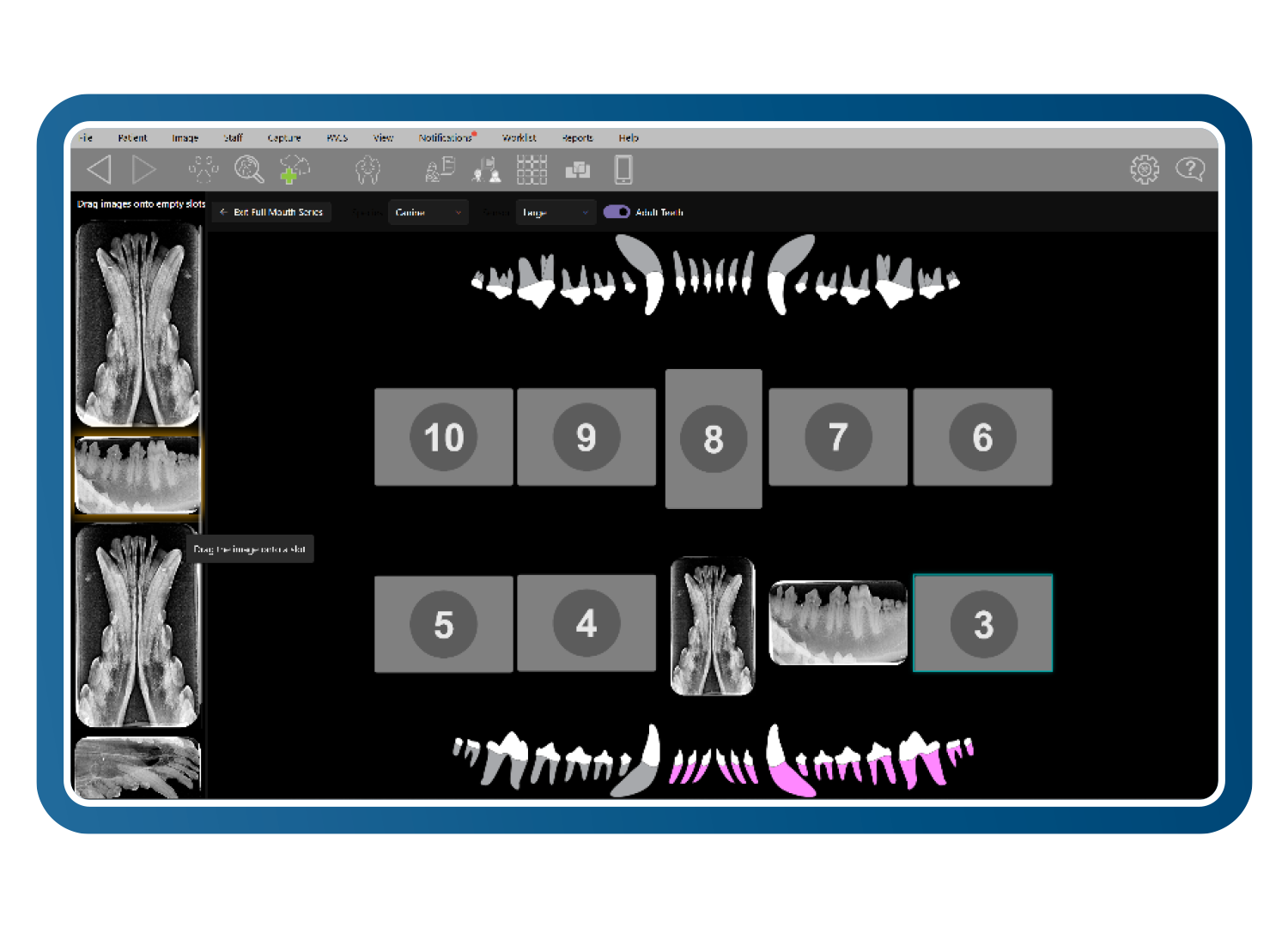 Intuitive Full-mouth dental layout interface