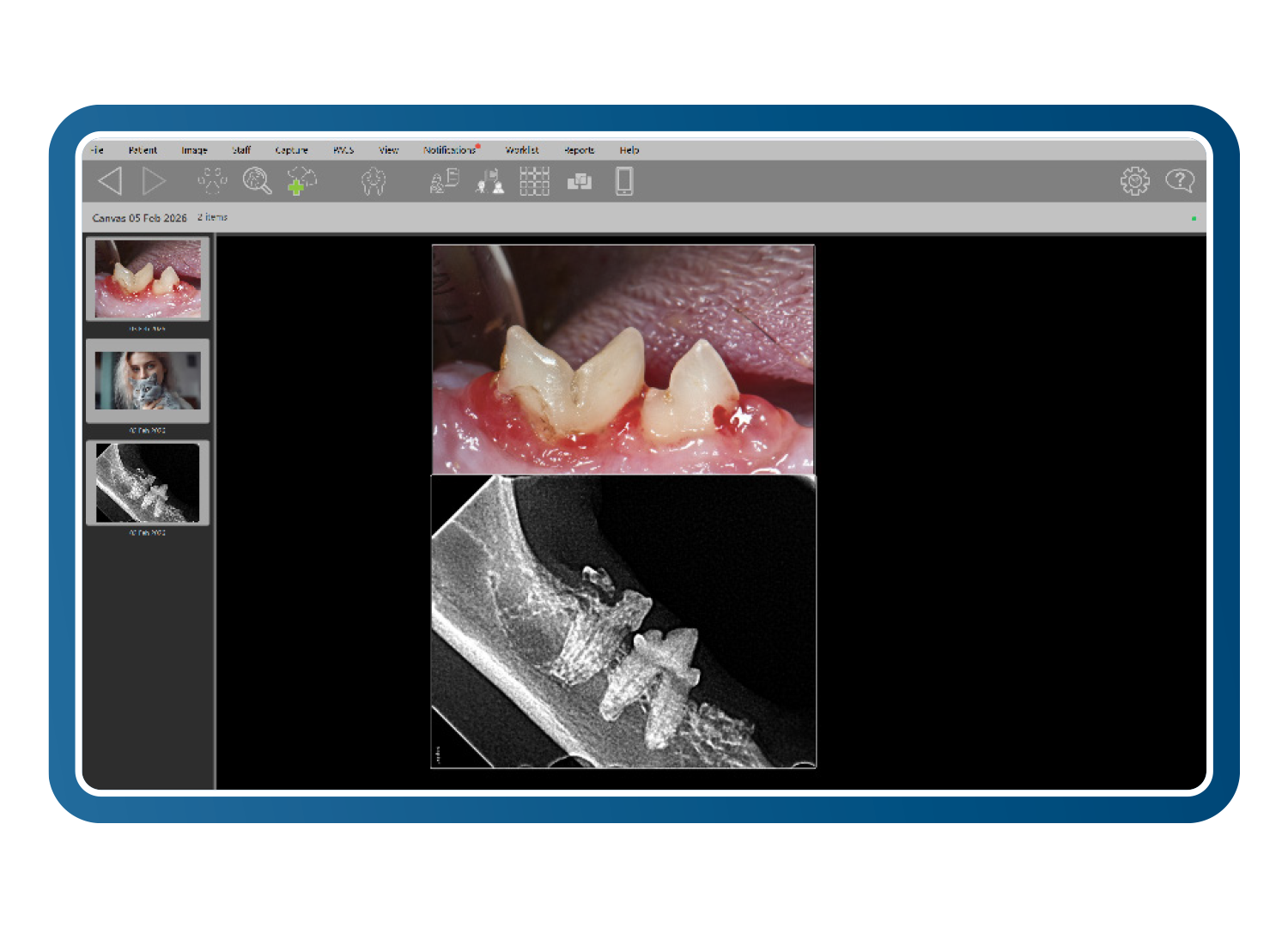 Full-mouth dental layout interface free form layout