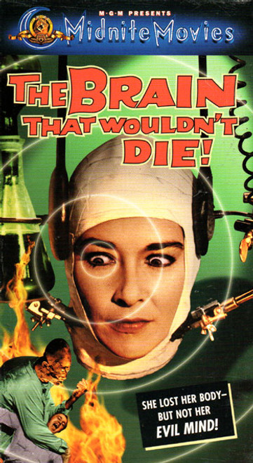 BRAIN THAT WOULDN'T DIE (1959/Synapse) - DVD