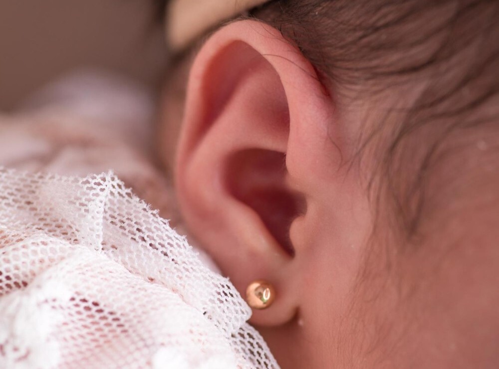 Farmacia La Murada Perforación de Lóbulo