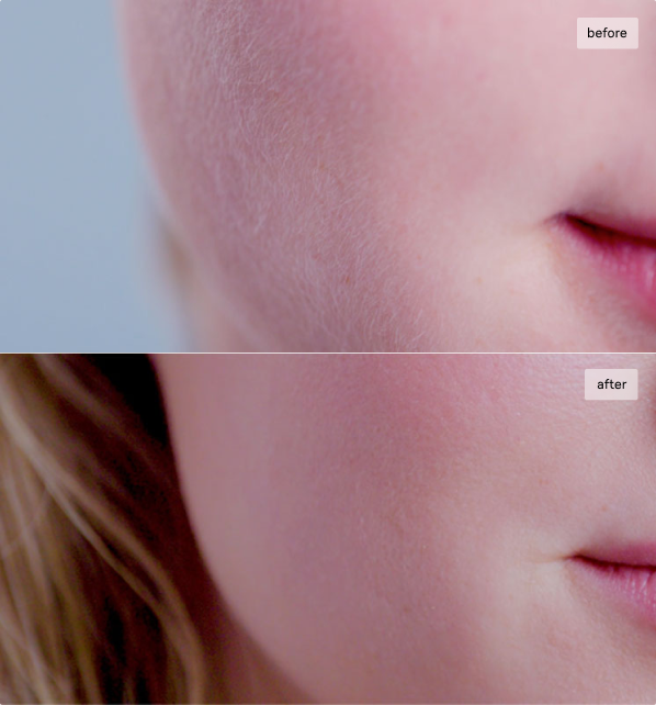 Before and After