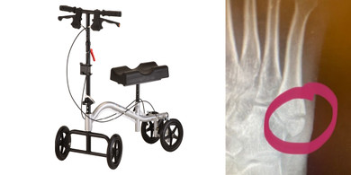 Knee Walkers: My Favorite Products