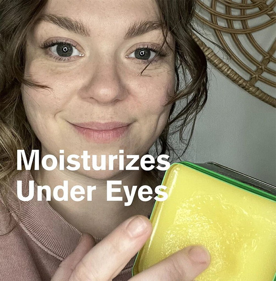 Bag Balm Hand & Body Skin Moisturizer - 8 oz