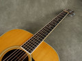 Martin 1978 D-35 Acoustic Guitar - Natural w/Hard Case - 2nd Hand