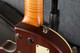 National Guitars Resolectric Guitars - Sunburst - Hard Case - 2nd Hand (127073) National Guitars Resolectric Guitars - Sunburst - Hard Case - 2nd Hand (127073)