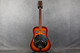 Hohner HR-100 Resonator - Sunburst - 2nd Hand