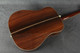 Blazer & Henkes D-42 - Sunburst - Hard Case - 2nd Hand