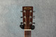 Martin 000-15 - 2nd Hand