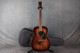 Martin 000-16 StreetMaster - Dark Mahogany - 2nd Hand