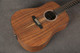 Martin X Series D-X1E Koa Electro Acoustic - 2nd Hand Martin X Series D-X1E Koa Electro Acoustic - 2nd Hand
