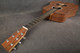 Martin X Series D-X1E Koa Electro Acoustic - 2nd Hand Martin X Series D-X1E Koa Electro Acoustic - 2nd Hand