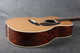 Martin Custom Shop 00 - Madagascan Rosewood - 2nd Hand