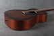 Martin 000-15M - Custom Burst - 2nd Hand