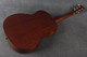 Martin 000-15M - Custom Burst - 2nd Hand