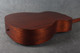 Martin 000-15M - Custom Burst - 2nd Hand
