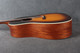 Martin DSS-17 - Whiskey Sunset - 2nd Hand