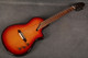 Martinez Hispania Thinline Electro Classical - Sunburst - 2nd Hand