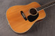 Martin D-35P - 1988 - 2nd Hand