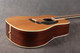 Martin D-35P - 1988 - 2nd Hand