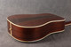 Martin D-35P - 1988 - 2nd Hand